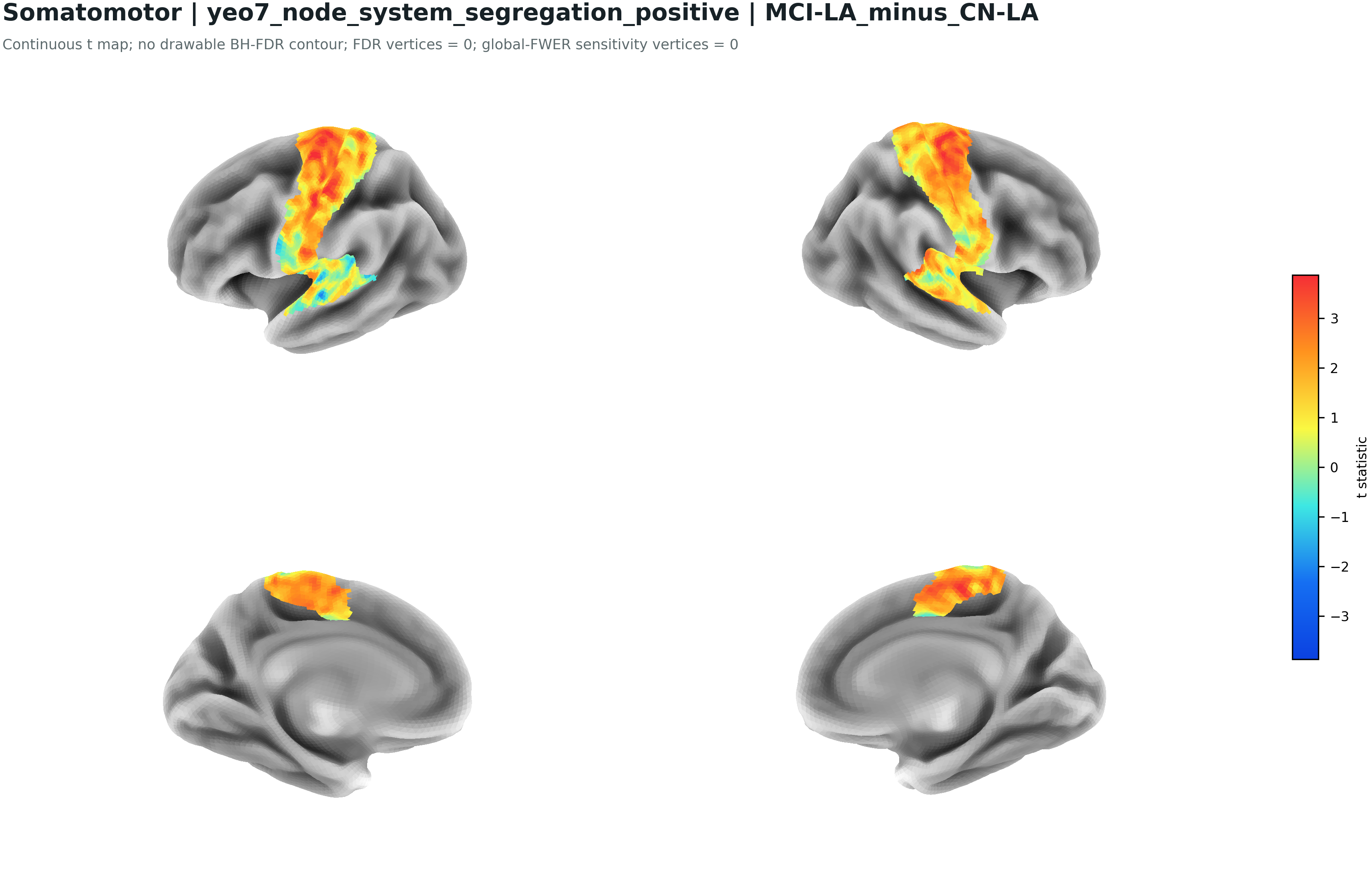 SMN positive local segregation MCI-LA minus CN-LA