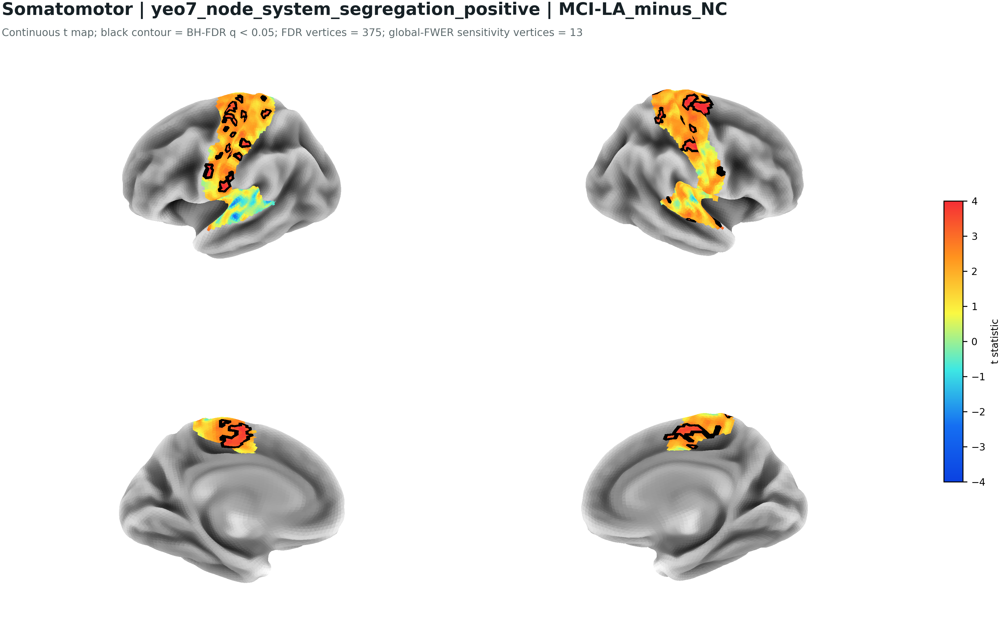 SMN positive local segregation MCI-LA minus NC